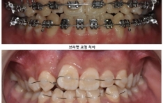 ����� ���� ġ�Ʊ���  �̴�񵿺���